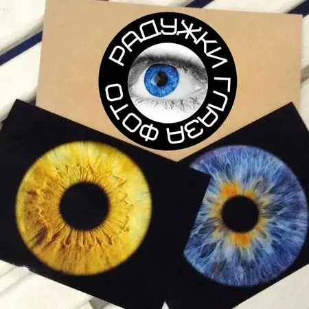 ФОТО РАДУЖКИ ГЛАЗА